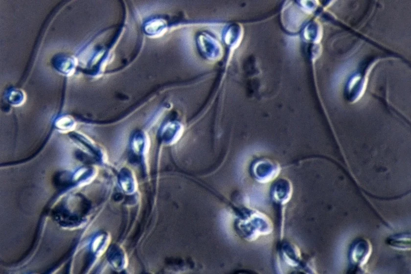 spermatozoids śpiermatazoidy śpiermatozoidy